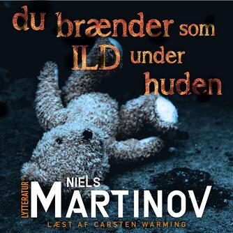 Niels Martinov: Du brænder som ild under huden