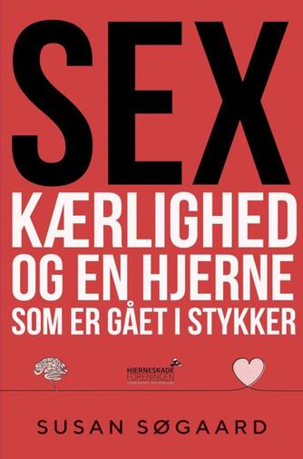 Susan Søgaard: Sex, kærlighed og en hjerne som er gået i stykker